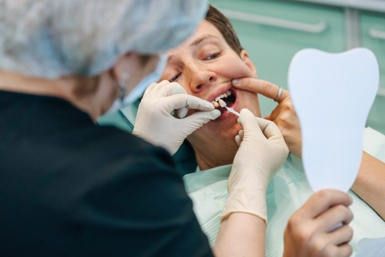 A Person Getting Porcelain Dental Veneers | Dentistry at Ivy Falls